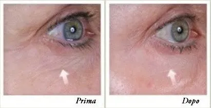 Total Eye Repair Serum S.